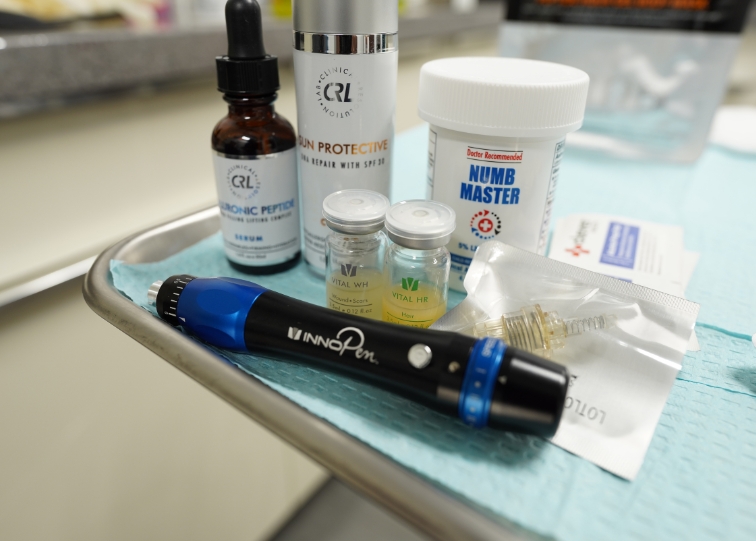 Microneedling Session