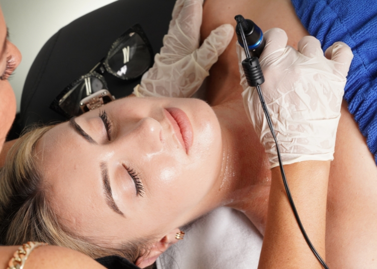 Post-Microneedling Aftercare: How to Heal Faster and Maximize Results